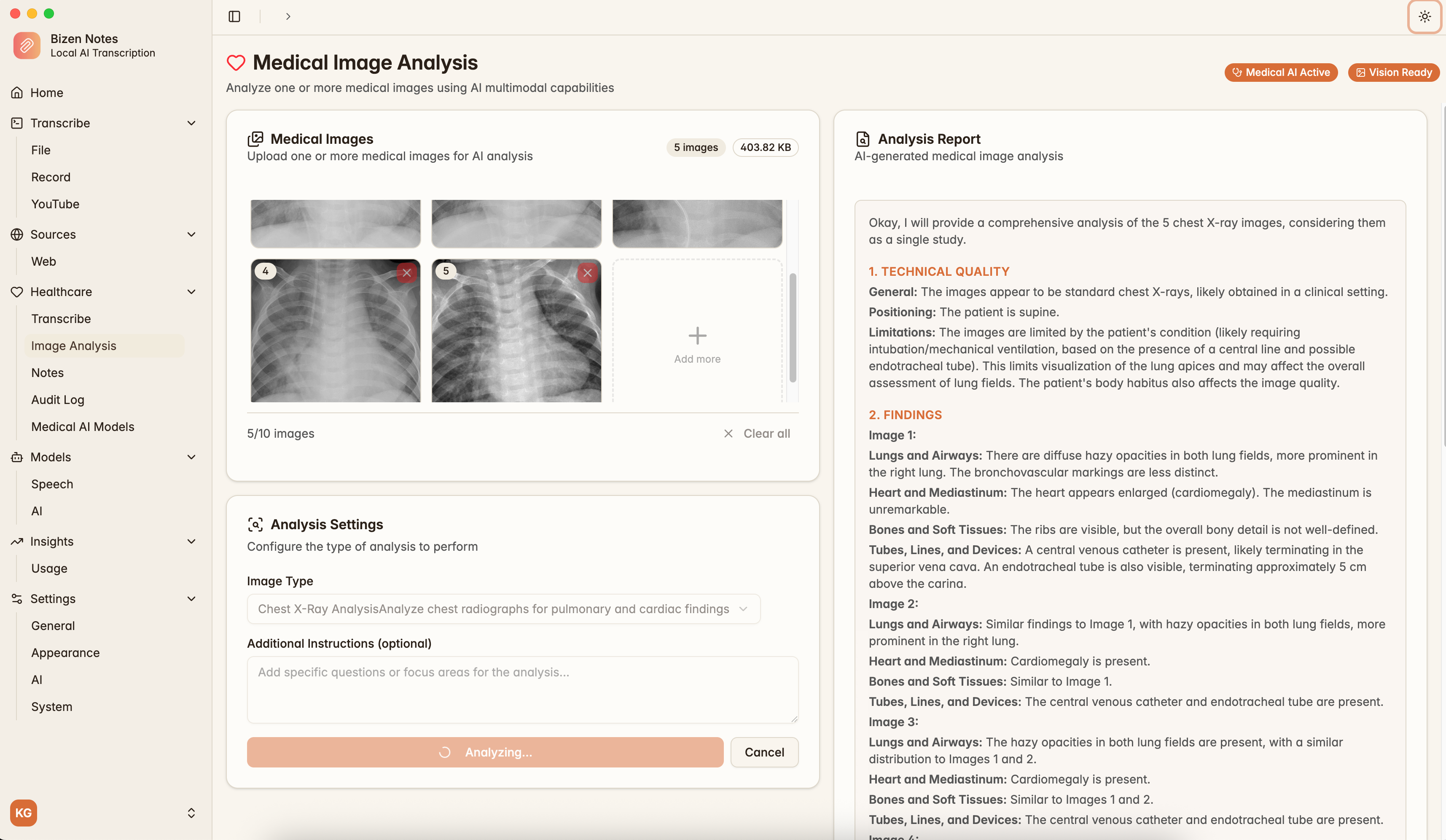 Healthcare AI Scribe - SOAP Note Template